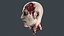 Severed Head 2