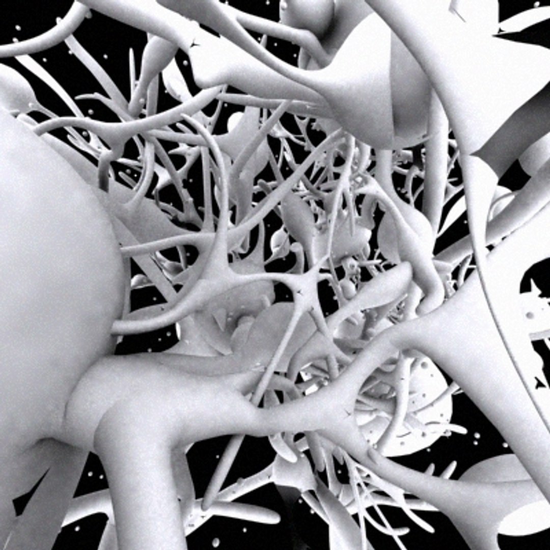 Brain Tumor 3d Model