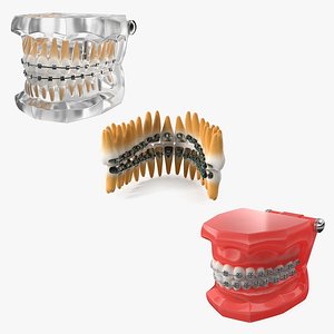 Dental Typodonts With Bracket Collection 3D model