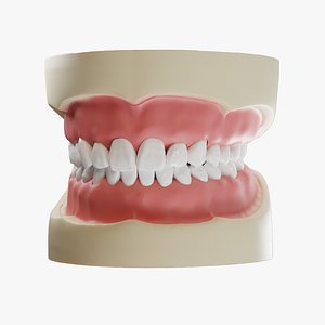 full jaw