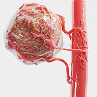 Vessel Tumor