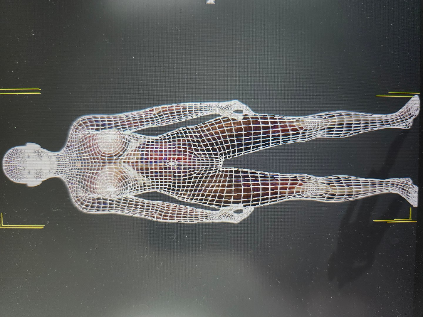 3D Skinless https://p.turbosquid.com/ts-thumb/2u/iB1PVl/LA/20240430_154747/jpg/1714510433/1920x1080/fit_q87/95b1d89218bb5fd2de031c83da1fa17d223f266c/20240430_154747.jpg