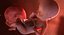 3D fetus 37 development