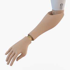 Prosthetic Arm