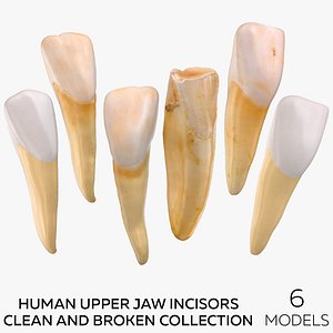 Human Upper Jaw Incisors Clean and Broken Collection - 6 models 3D