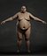 Overweight Human Anatomy
