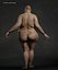Overweight Human Anatomy
