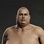 Overweight Human Anatomy