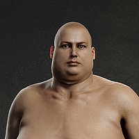 Overweight Human Anatomy