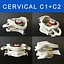 Vertebrae C1+C2