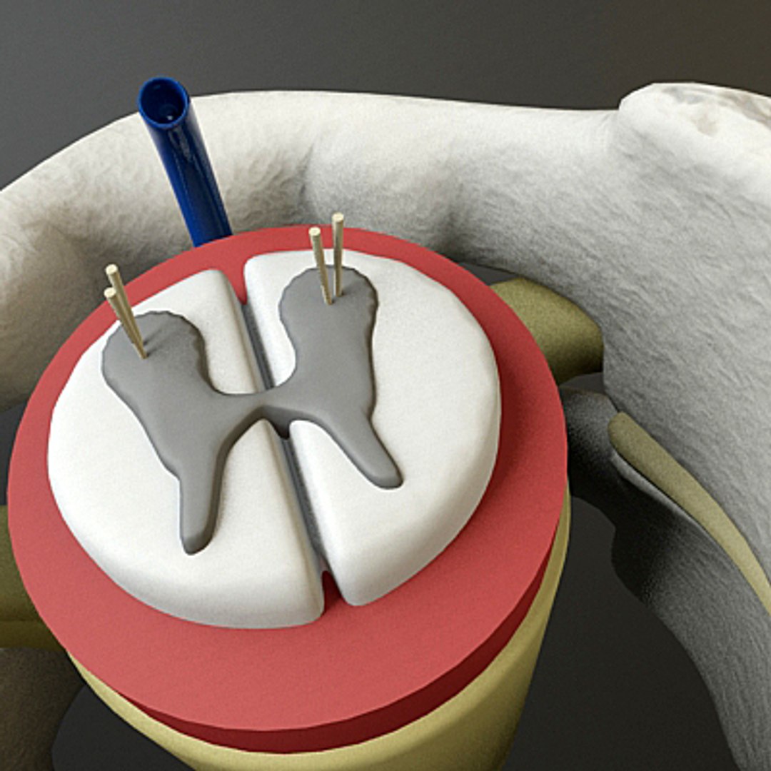 3ds max c1 c2 vertebrae https://p.turbosquid.com/ts-thumb/3S/vP6tmO/gDMToqul/render9/jpg/1286063893/1920x1080/fit_q87/cd1bb2f29505a933c5b44457f01a6f62d19b6ebb/render9.jpg