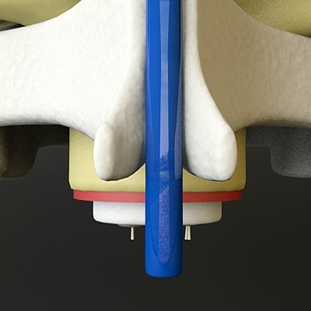 3ds max c1 c2 vertebrae https://p.turbosquid.com/ts-thumb/3S/vP6tmO/hBYzuBoU/render6/jpg/1286063893/1920x1080/fit_q87/e539c4324486457f3432b4bf38e58b1447e1a290/render6.jpg