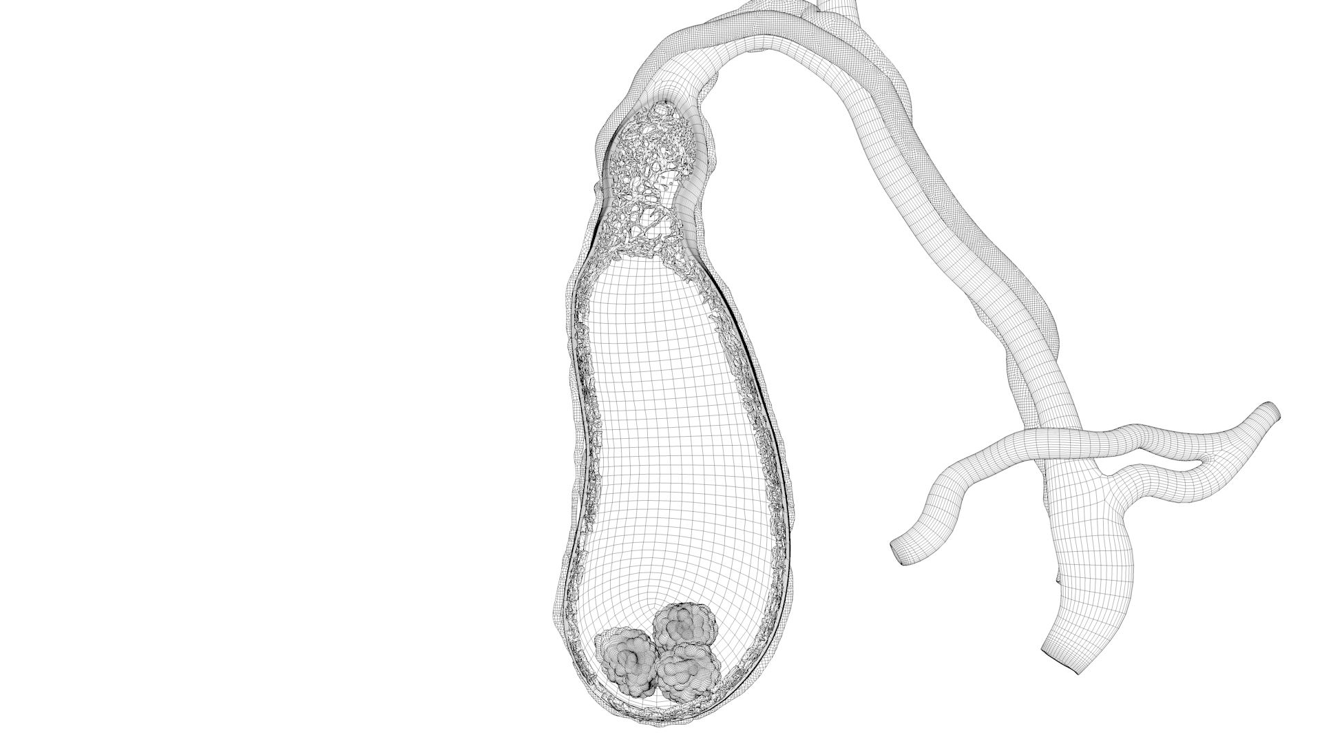 human gall bladder model https://p.turbosquid.com/ts-thumb/3V/NvR5pk/6kxuUOS2/bladderturn03/jpg/1494684459/1920x1080/turn_fit_q99/1aae0bdc79bee0b3a4fcbc62b82745472822b06c/bladderturn03-1.jpg