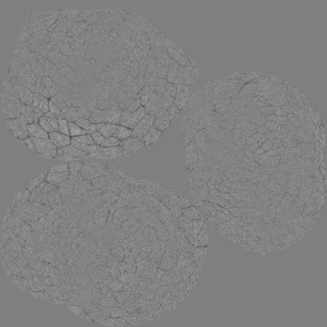 human gall bladder model https://p.turbosquid.com/ts-thumb/3V/NvR5pk/UeEvT6Qv/stonesdisplace/png/1494684689/1920x1080/fit_q87/f41df861668e36eb03733ee5d7ee466707257cfa/stonesdisplace.jpg