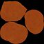 Gallbladder Gall Bladder