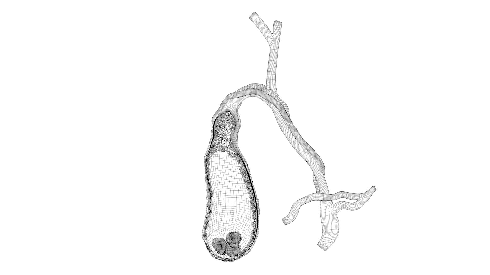 human gall bladder model https://p.turbosquid.com/ts-thumb/3V/NvR5pk/x4HWzyjJ/bladderturn02/jpg/1494684368/1920x1080/turn_fit_q99/40b7e39d64035d038033838dc5f9eb4437dc9604/bladderturn02-1.jpg