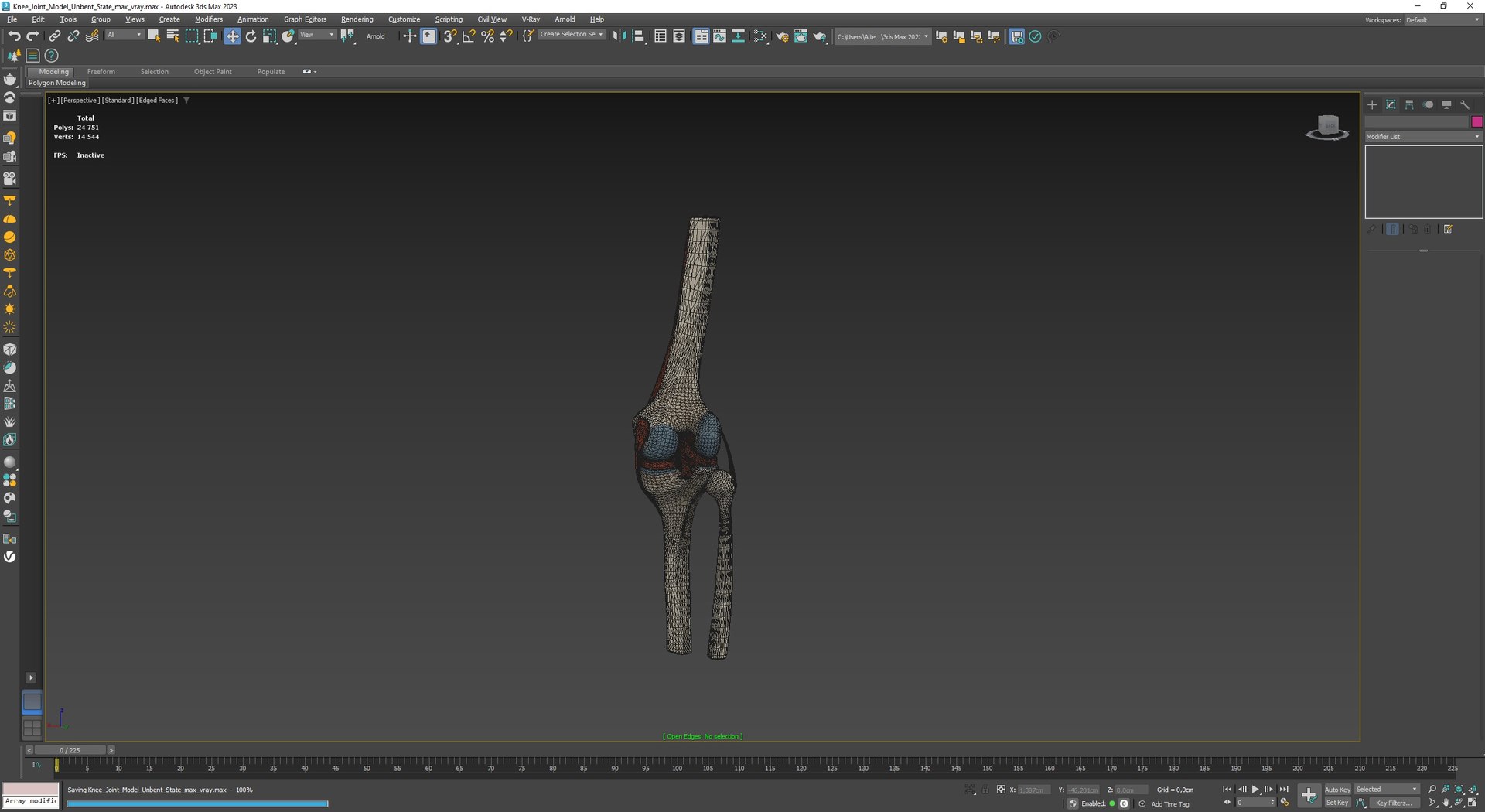 Knee Joint Model Unbent State for 3D Print 3D model preview