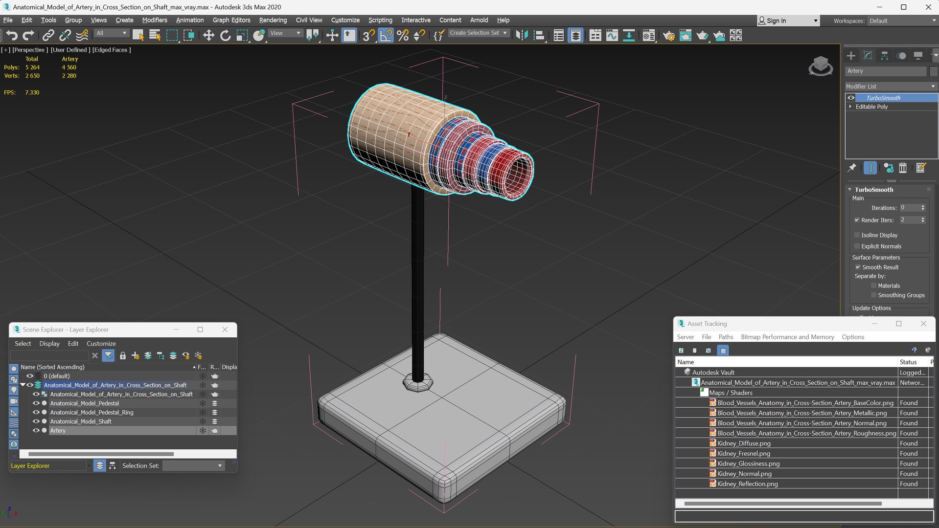 Anatomical Model of Artery in Cross Section on Shaft 3D model https://p.turbosquid.com/ts-thumb/3g/k5r1MX/hP/anatomical_model_of_artery_in_cross_section_on_shaft_015/jpg/1746909308/1920x1080/fit_q87/f454f0b24ffd2677a5278c92e7f5cbe94dac808c/anatomical_model_of_artery_in_cross_section_on_shaft_015.jpg