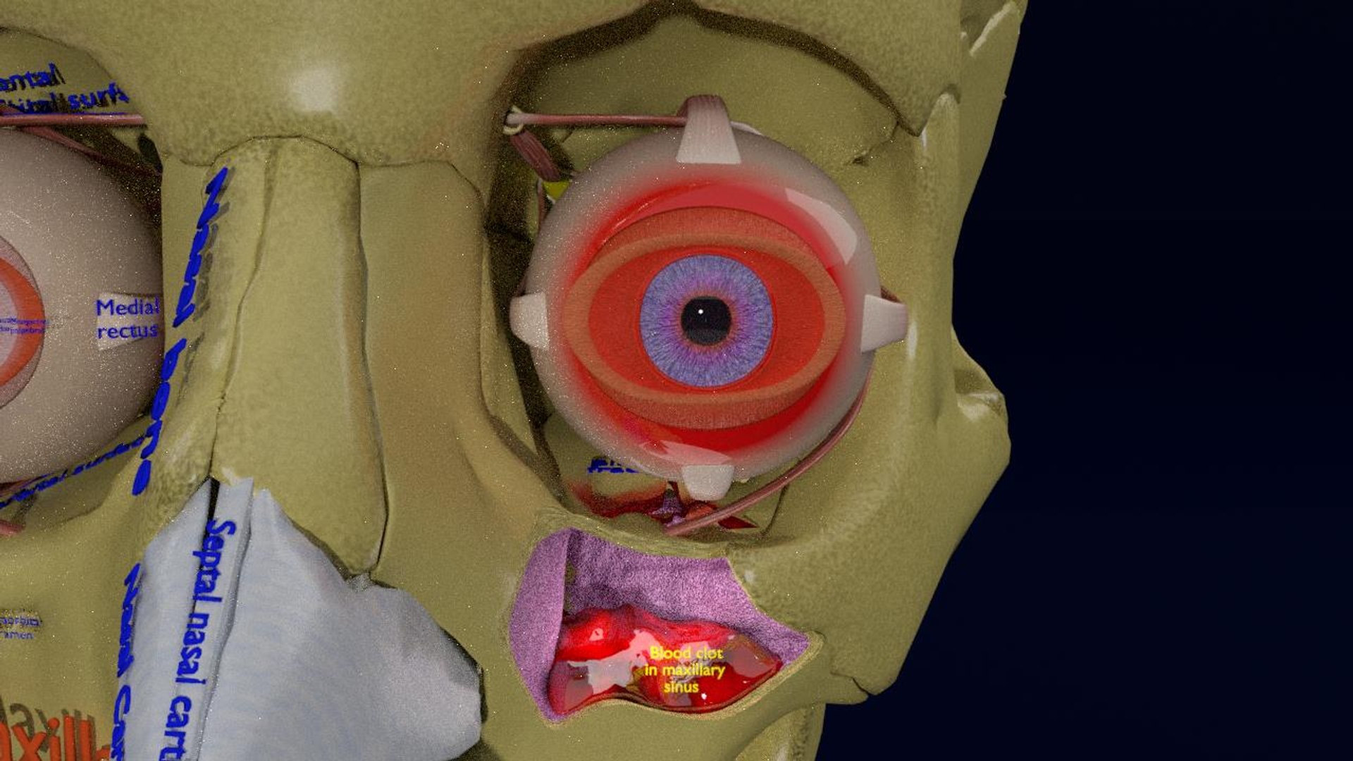 Eye blow out model - TurboSquid 1773924