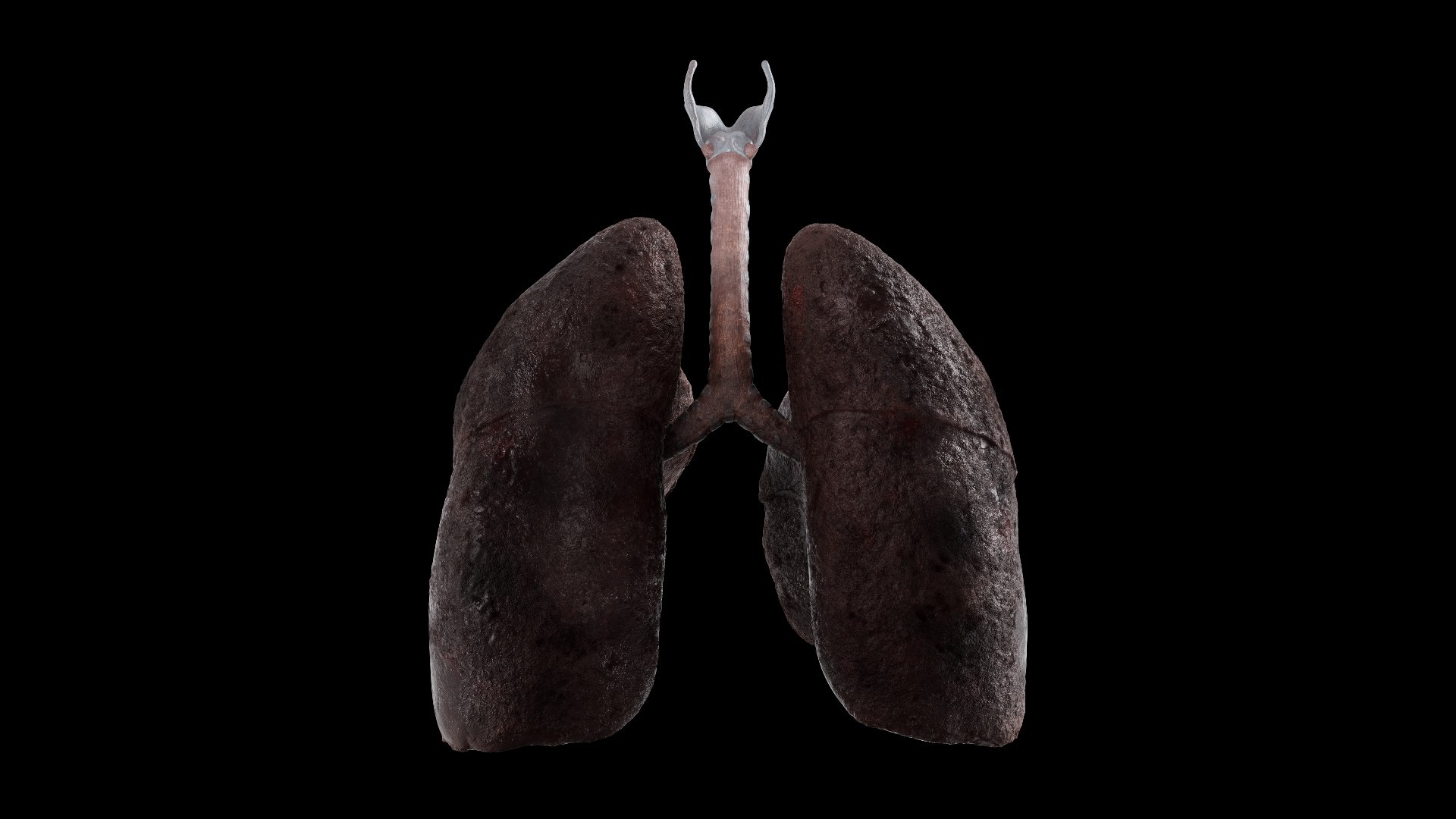 Smoker Lungs Anatomy 3D - TurboSquid 1912047