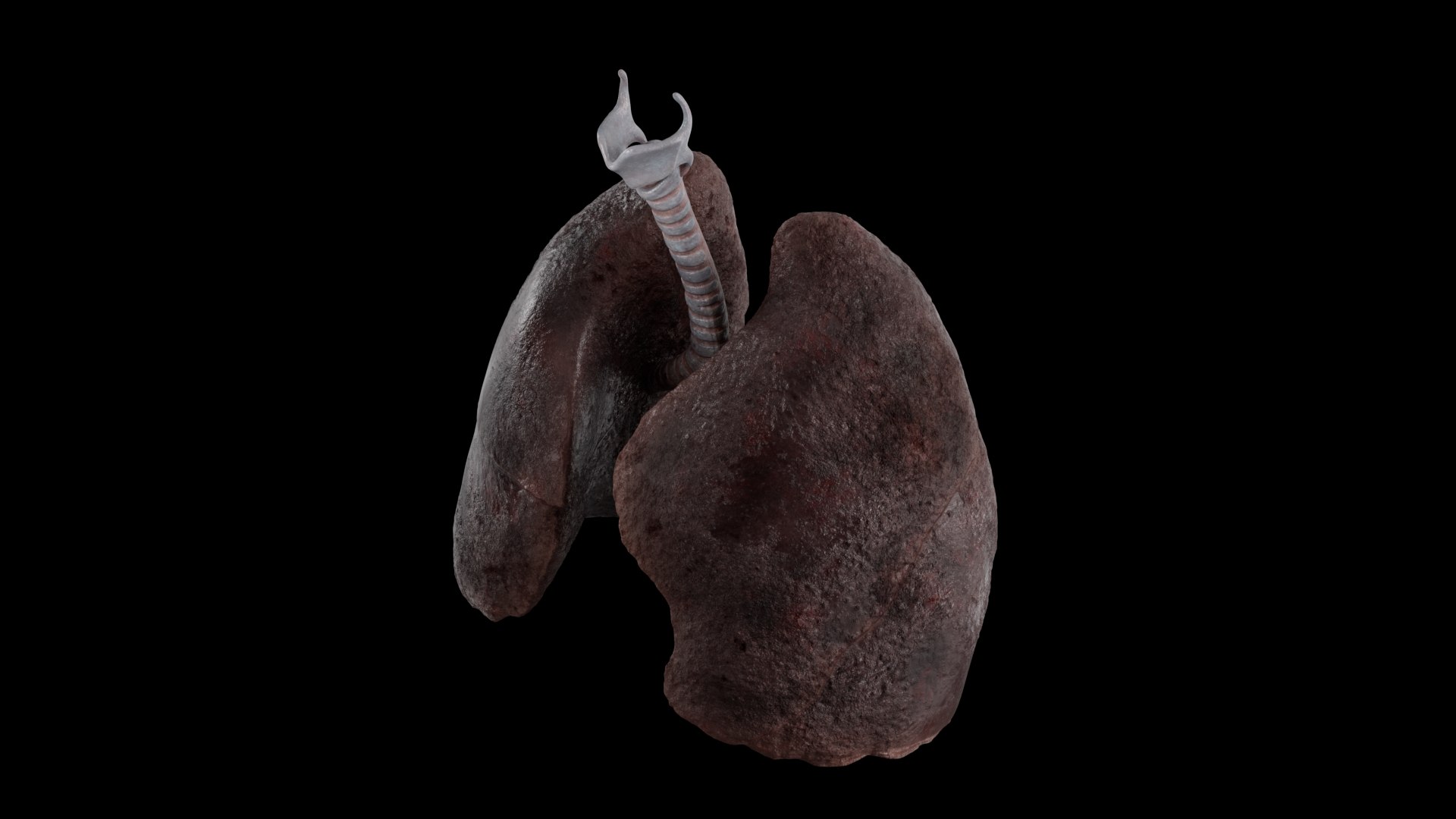 Smoker Lungs Anatomy 3D - TurboSquid 1912047