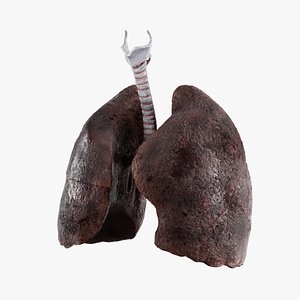 Smoker Lungs Anatomy 3D