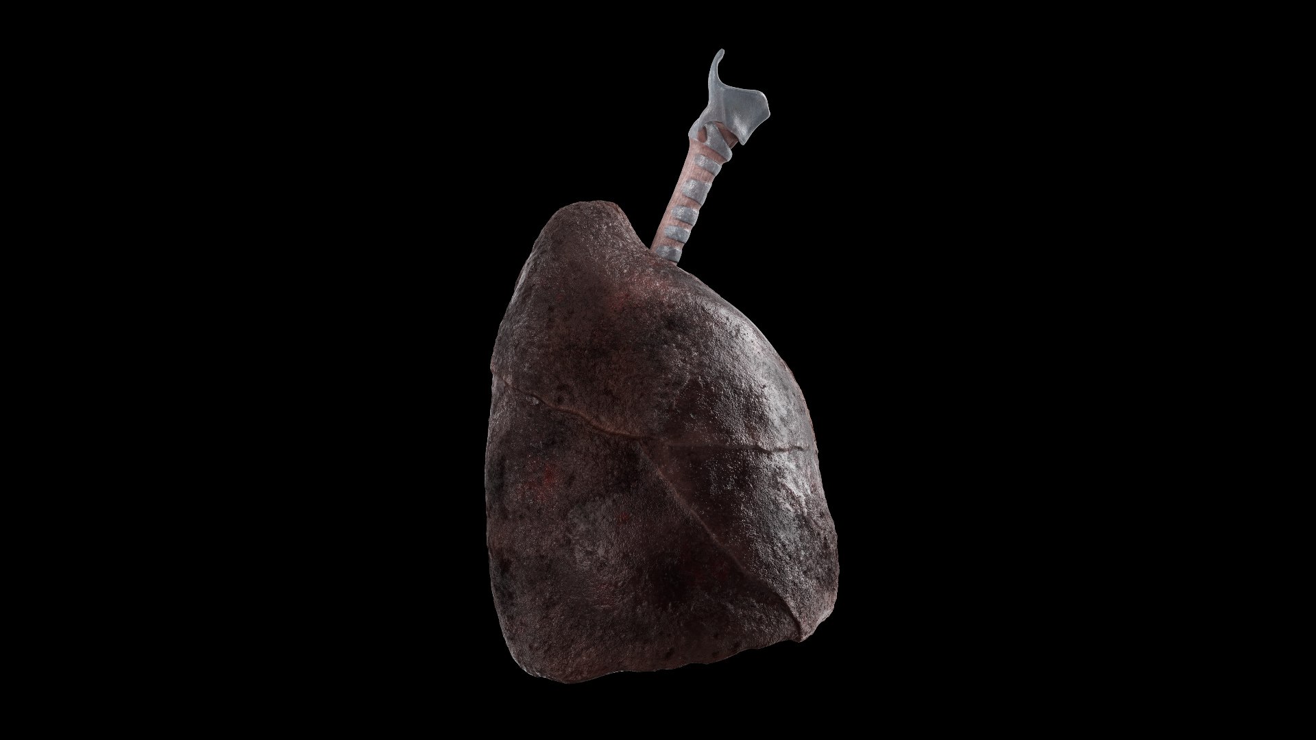 Smoker Lungs Anatomy 3D - TurboSquid 1912047