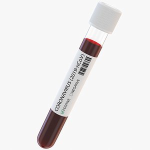 Coronavirus Test Tube
