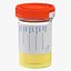Urinari Sample Cups Collection