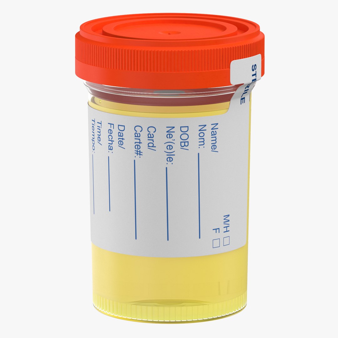 3D urinari sample cups https://p.turbosquid.com/ts-thumb/3r/c4ribE/kXFdBHa0/urine_sample_mostly_full_thumbnail_square_0000/jpg/1538998239/1920x1080/fit_q87/0b5e6735b549bf30d2d2810ea548d6b4b0f6766f/urine_sample_mostly_full_thumbnail_square_0000.jpg