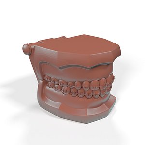 Ligature Braces on Teeth Model for 3D Print