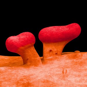 EHEC bacteria