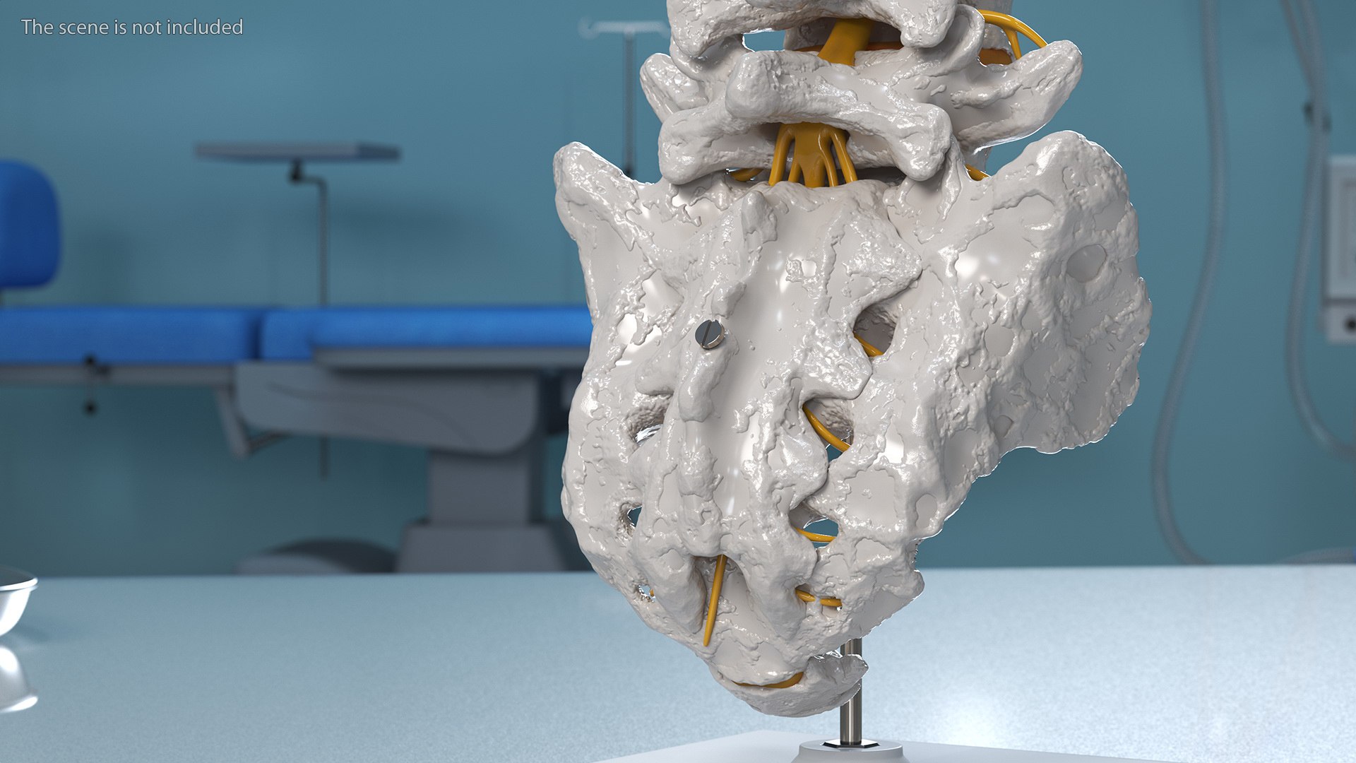 3D Intervertebral Disc Implant Installed on Spine https://p.turbosquid.com/ts-thumb/4G/6i9bTs/8G/intervertebraldiscimplantinstalledonspinec4dmodel004/jpg/1710696896/1920x1080/fit_q87/1594818414c91cfbca6d8aa7bf9430ead4c3095c/intervertebraldiscimplantinstalledonspinec4dmodel004.jpg