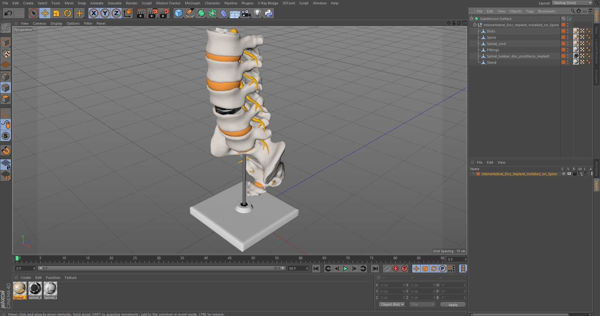 3D Intervertebral Disc Implant Installed on Spine https://p.turbosquid.com/ts-thumb/4G/6i9bTs/Yp/intervertebral_disc_implant_installed_on_spine_1003/jpg/1710747067/1920x1080/fit_q87/00e913eaca8986492723553a48286cd80c6b99a7/intervertebral_disc_implant_installed_on_spine_1003.jpg