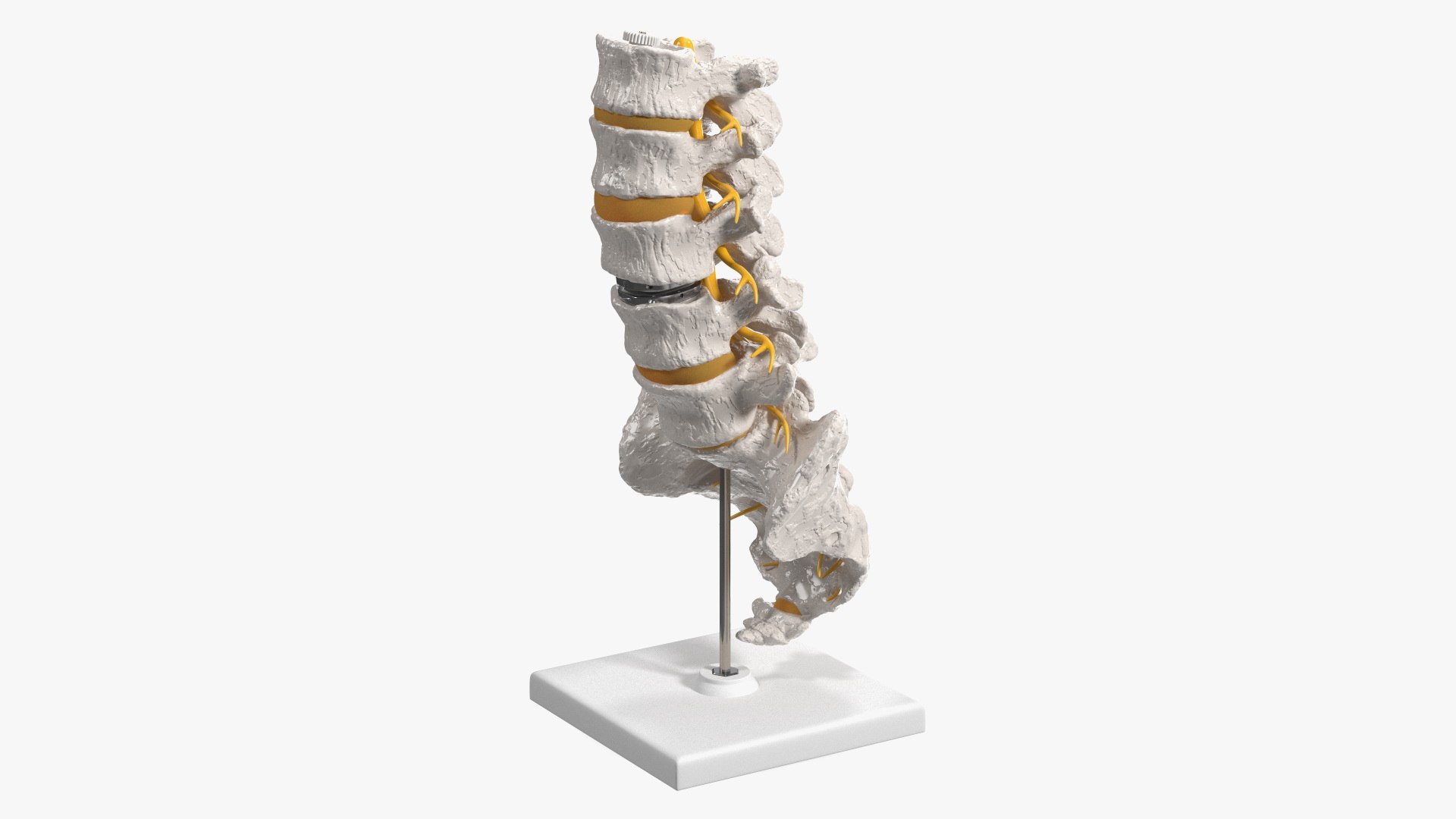 Intervertebral Disc Implant Installed on Spine 3D model preview