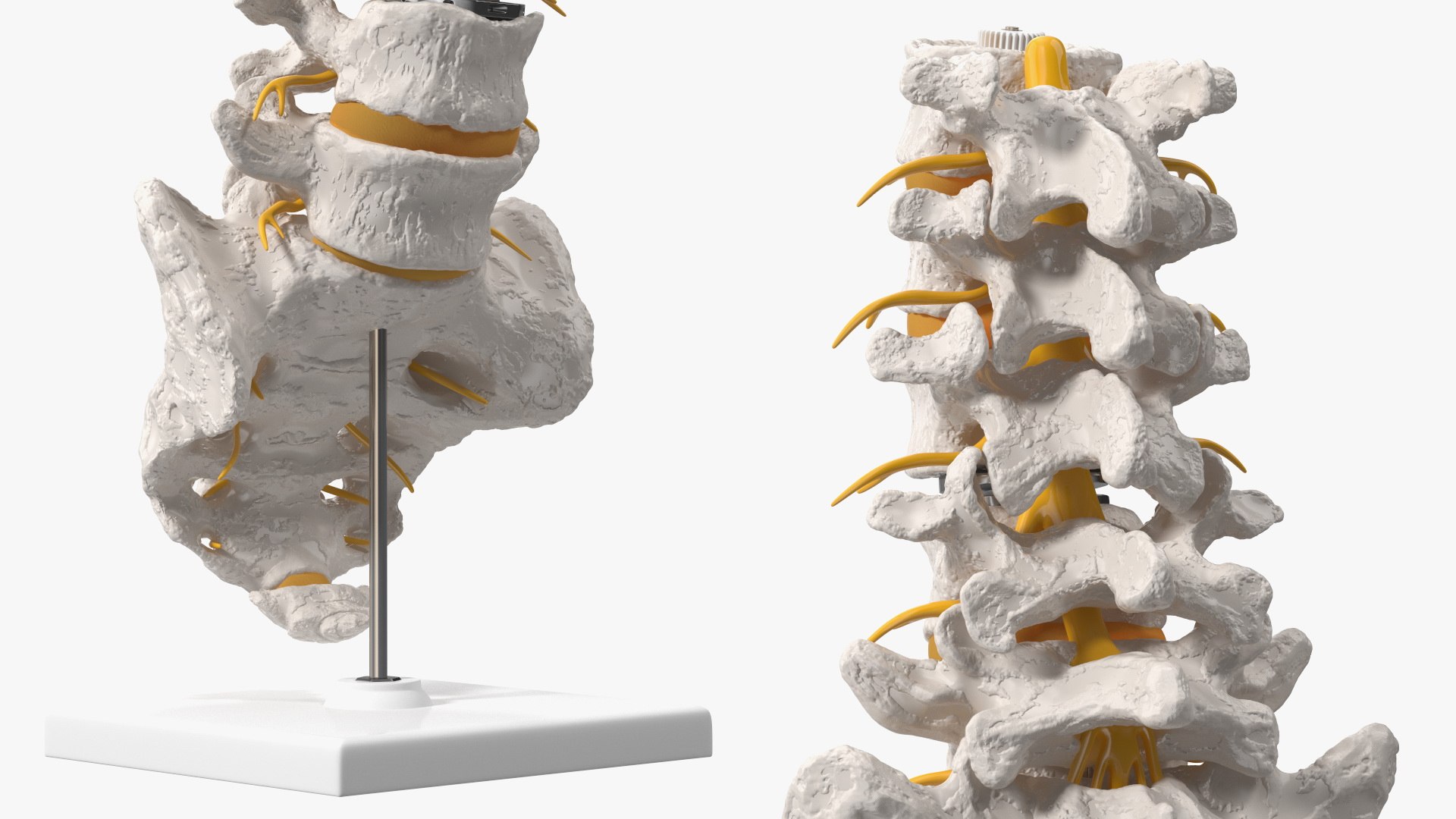 3D Intervertebral Disc Implant Installed on Spine https://p.turbosquid.com/ts-thumb/4G/6i9bTs/w7/intervertebraldiscimplantinstalledonspinec4dmodel013/jpg/1710696919/1920x1080/fit_q87/da65548824f6b3dc062d7d511ad3e6fcf12f9d29/intervertebraldiscimplantinstalledonspinec4dmodel013.jpg