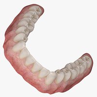 Dentures Lower