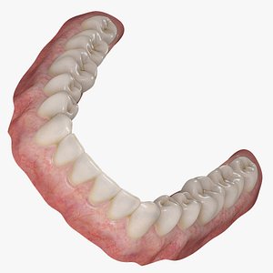 Dentures Lower