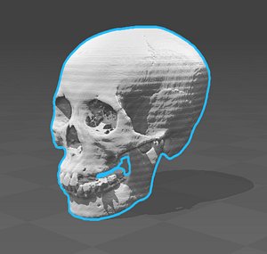 20 skulls data from CT scan (Asian)