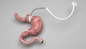 3D Stomach With Stomach Band model