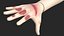 Injured Firstaid Mannequin Arm