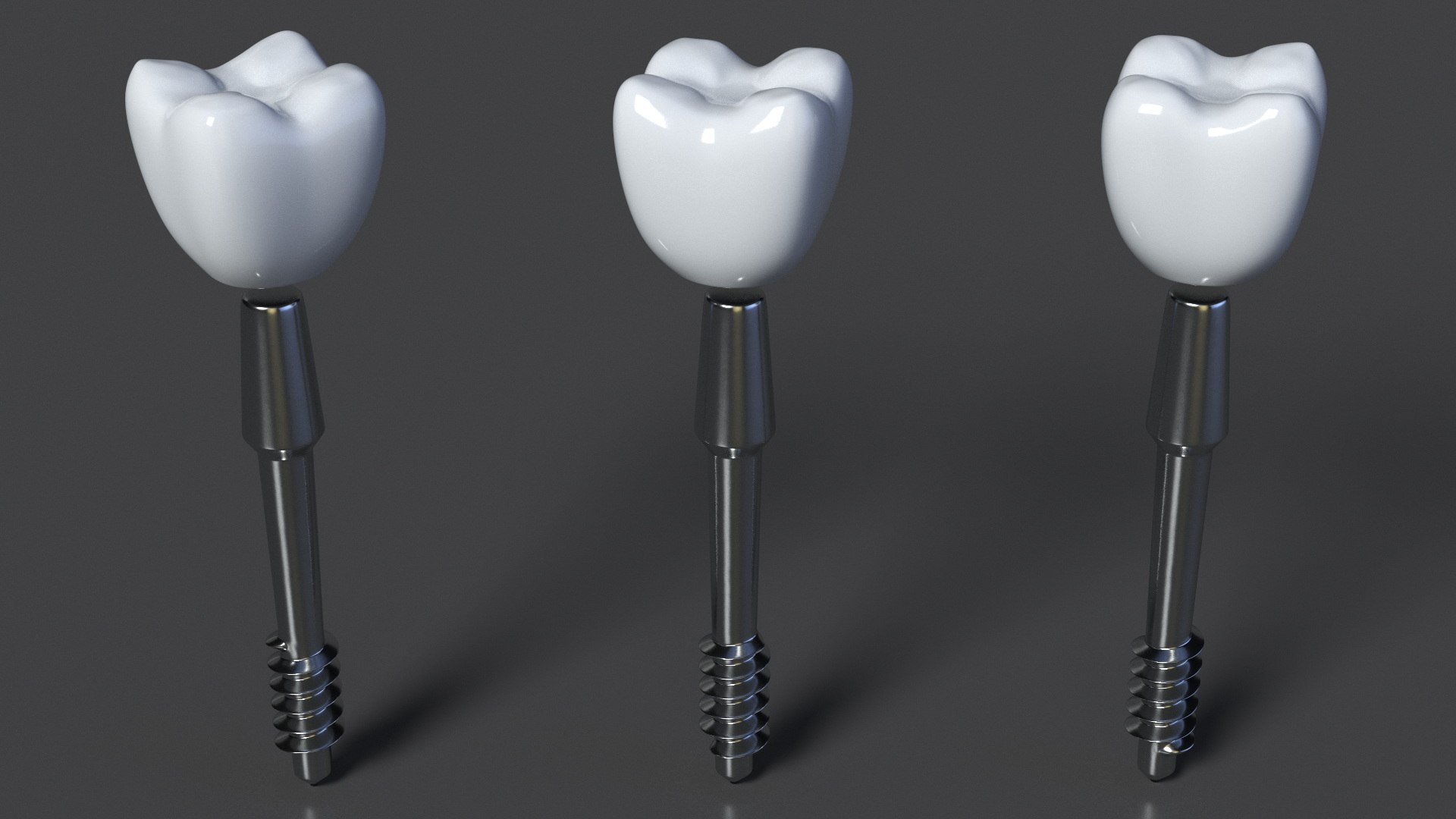 Tooth Implants Collection 2 3D model https://p.turbosquid.com/ts-thumb/4x/50dBRt/0T/toothimplantscollection23dsmodel006/jpg/1698620342/1920x1080/fit_q87/deb9ccb0b1bbd0a80b0db11262f552a1de007531/toothimplantscollection23dsmodel006.jpg