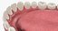 Colección de implantes dentales 2