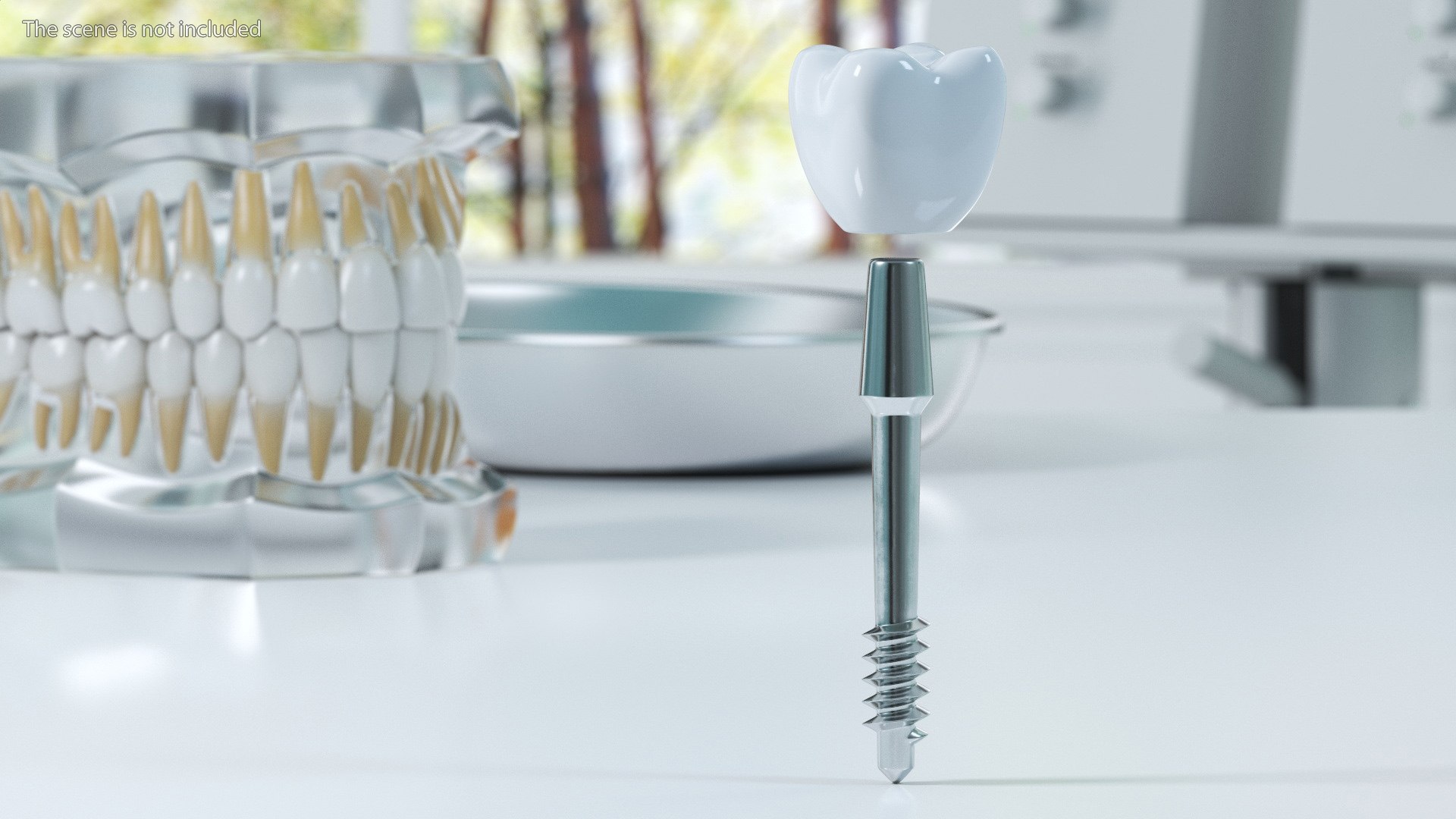 Tooth Implants Collection 2 3D model https://p.turbosquid.com/ts-thumb/4x/50dBRt/Fi/toothimplantscollection23dsmodel003/jpg/1698620331/1920x1080/fit_q87/b41e8627422e035f1a355f4de1a9517f7bda30e5/toothimplantscollection23dsmodel003.jpg