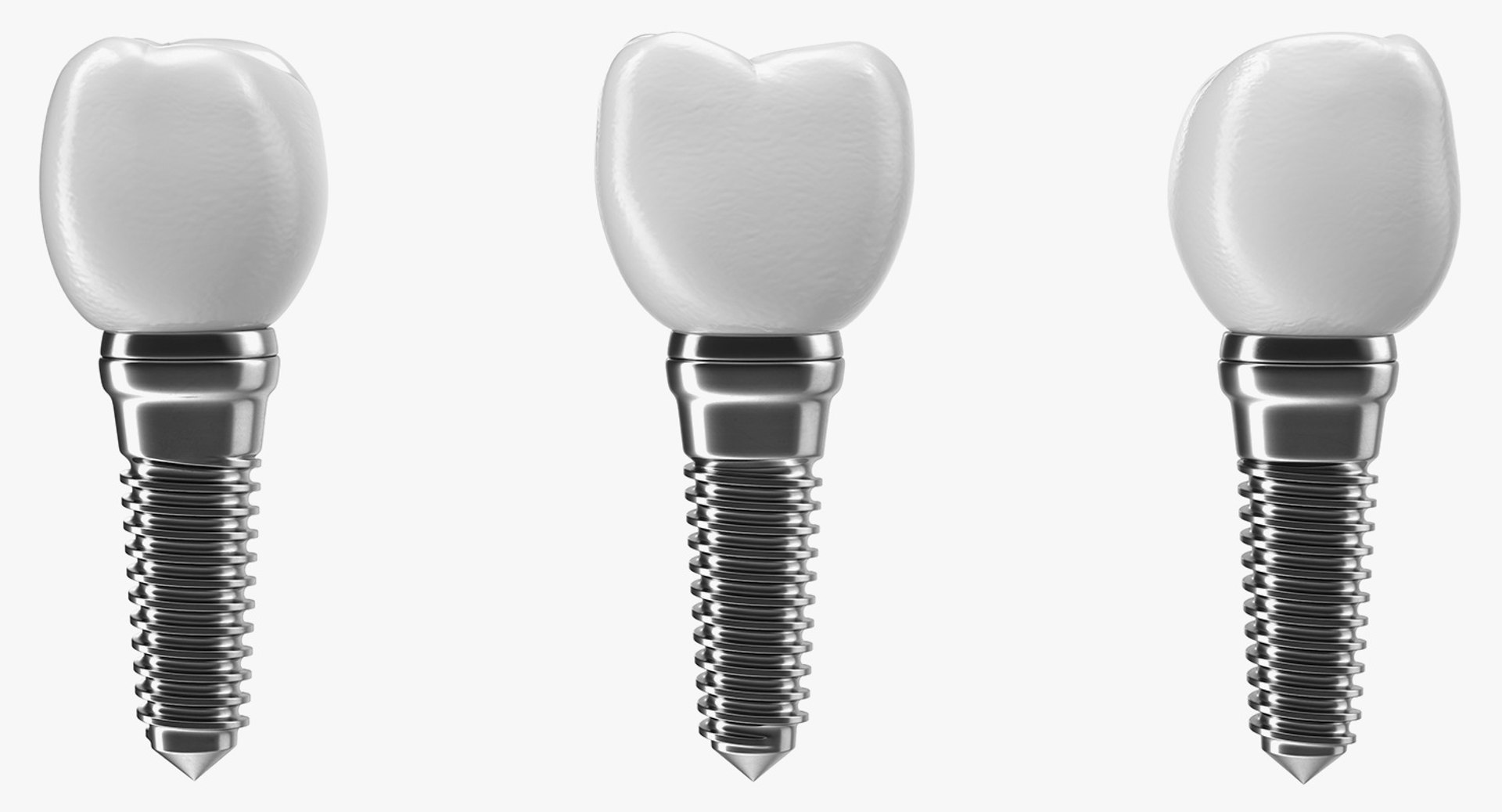 Tooth Implants Collection 2 3D model https://p.turbosquid.com/ts-thumb/4x/50dBRt/Jb/toothimplantscollection23dsmodel053/jpg/1698620532/1920x1080/fit_q87/e33f8a41dece6aefa789c46afcaed19603da6561/toothimplantscollection23dsmodel053.jpg