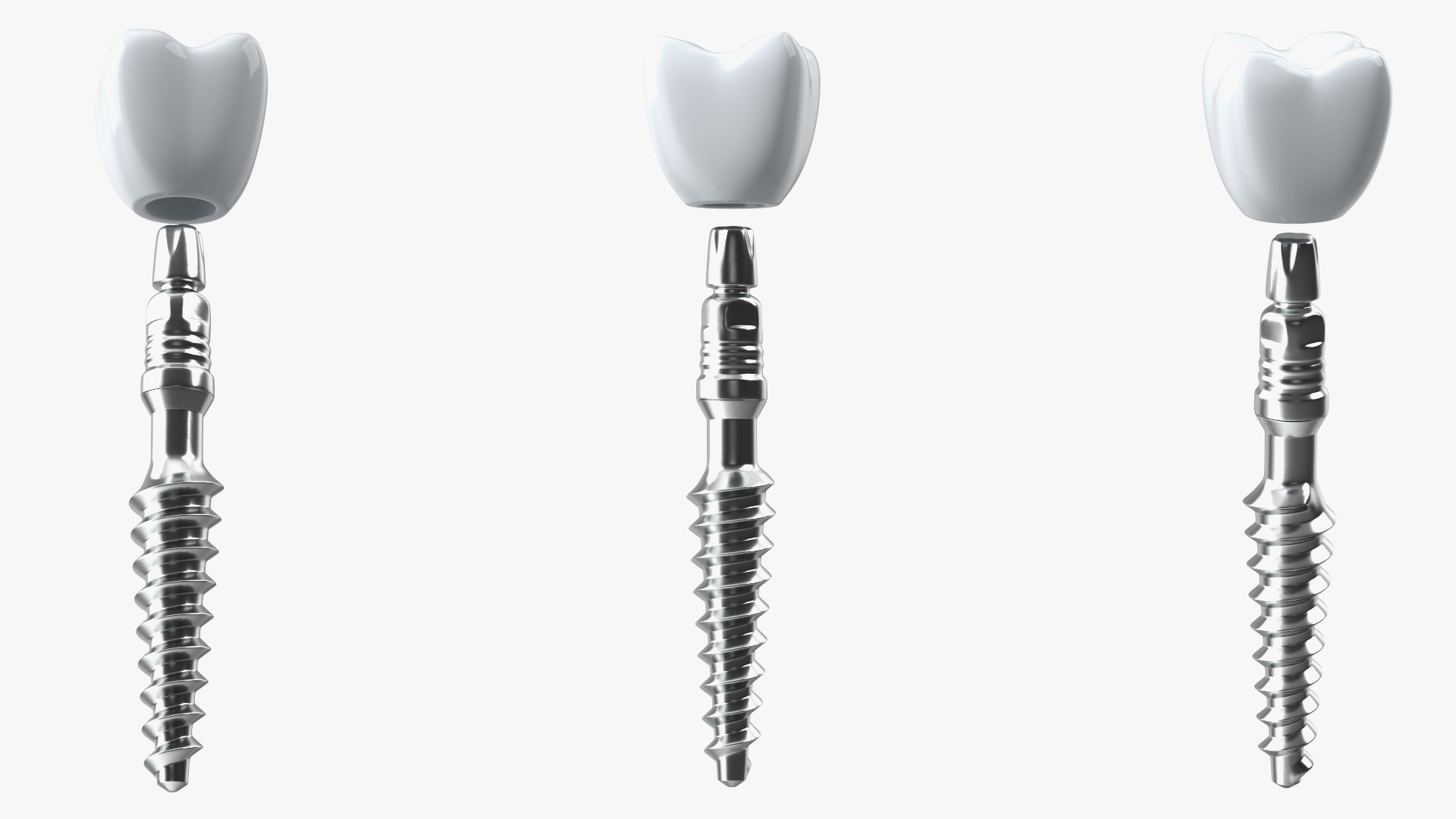 Tooth Implants Collection 2 3D model https://p.turbosquid.com/ts-thumb/4x/50dBRt/OS/toothimplantscollection23dsmodel022/jpg/1698620408/1920x1080/fit_q87/19fbe16eaaa0d10f04d9c1f0048b2881516a6e06/toothimplantscollection23dsmodel022.jpg