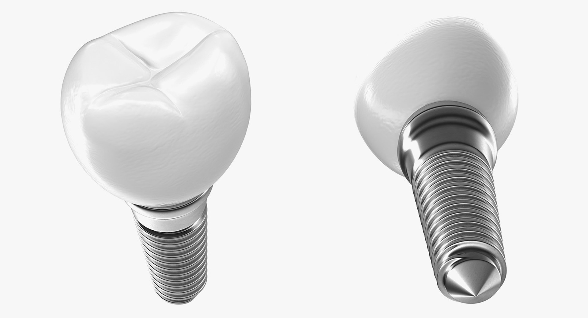 Tooth Implants Collection 2 3D model https://p.turbosquid.com/ts-thumb/4x/50dBRt/OW/toothimplantscollection23dsmodel054/jpg/1698620536/1920x1080/fit_q87/a9bd0955352205d9f1ae71a5d8930f0276bdefe4/toothimplantscollection23dsmodel054.jpg