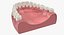 Colección de implantes dentales 2