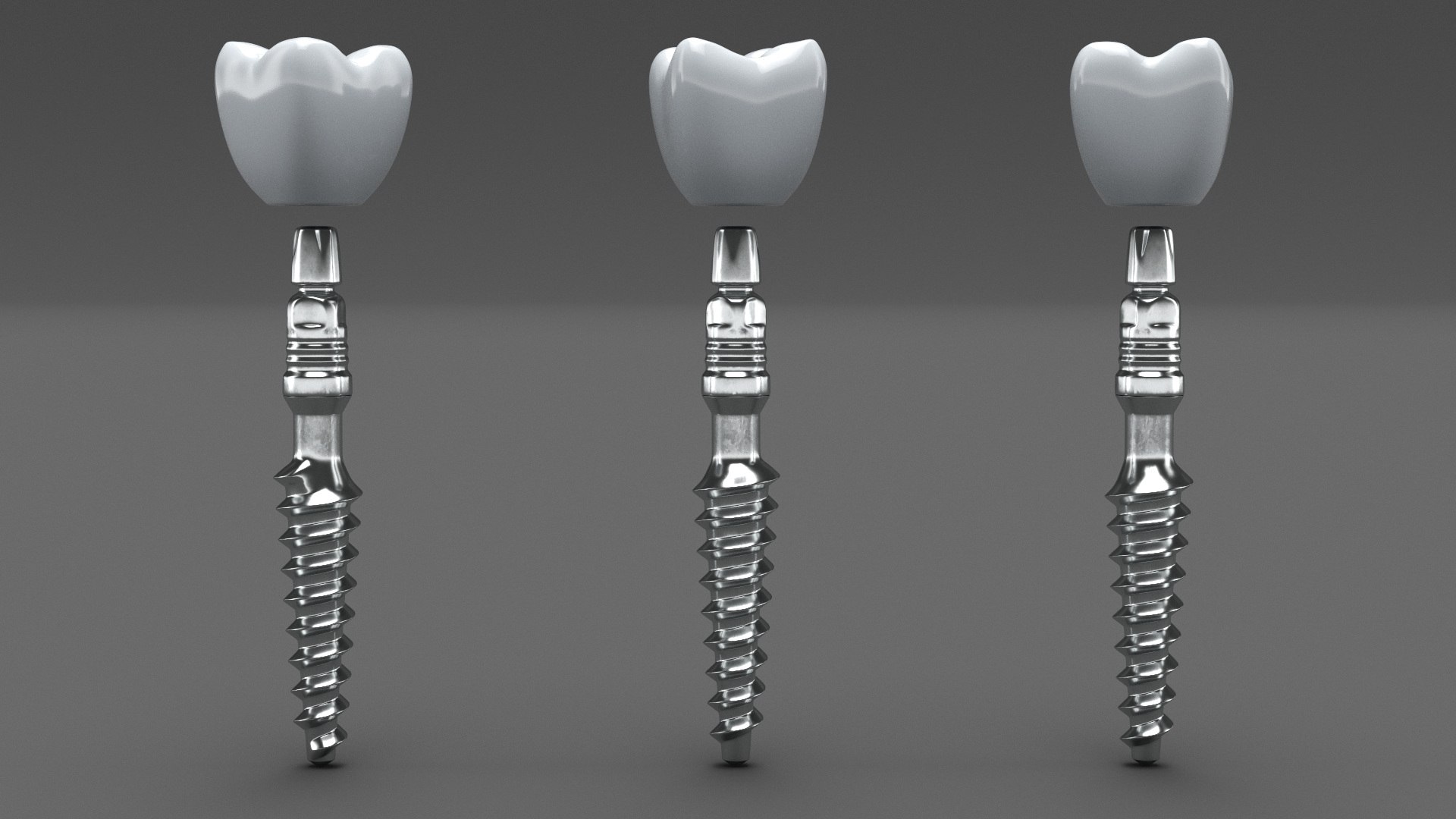 Tooth Implants Collection 2 3D model https://p.turbosquid.com/ts-thumb/4x/50dBRt/RH/toothimplantscollection23dsmodel018/jpg/1698620390/1920x1080/fit_q87/4c9886398b7fe2cb9fdd98ccebd5ec6d3b4f1da4/toothimplantscollection23dsmodel018.jpg
