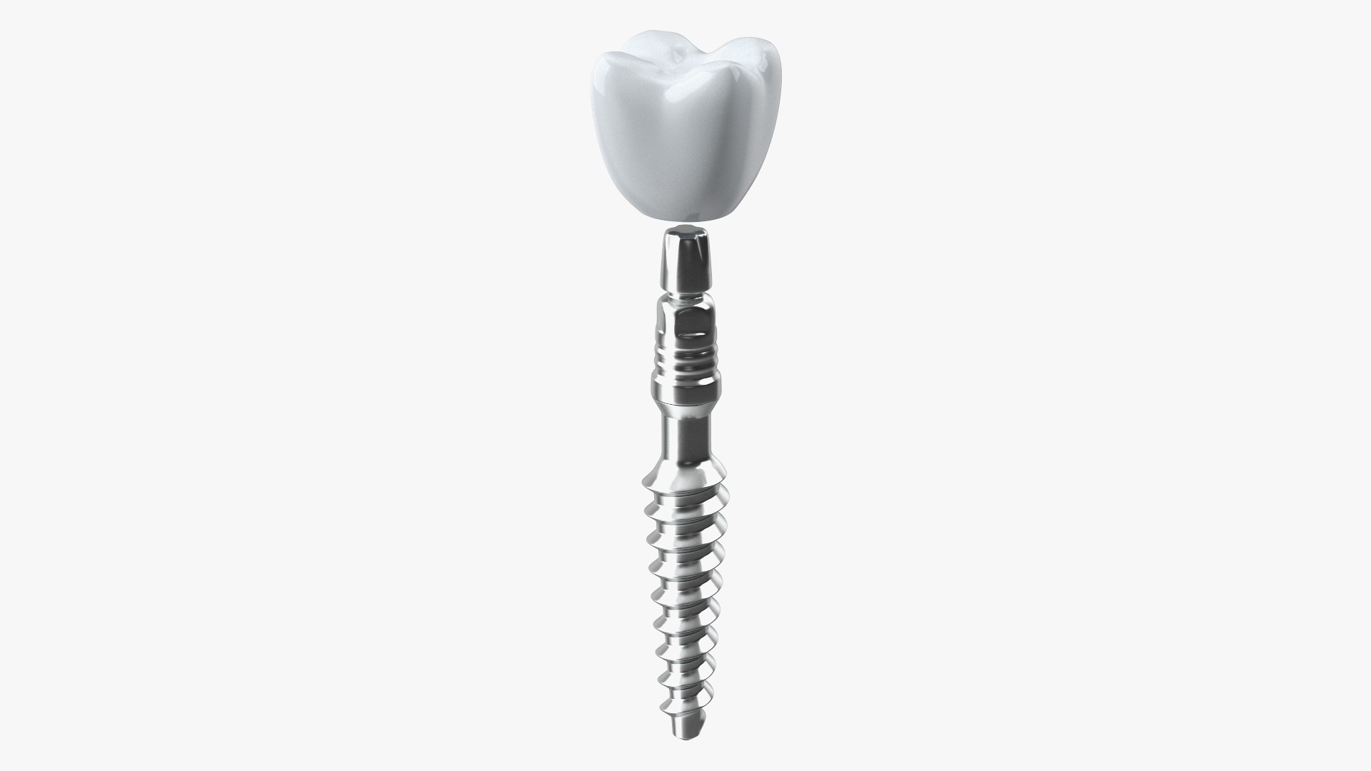 Tooth Implants Collection 2 3D model https://p.turbosquid.com/ts-thumb/4x/50dBRt/TL/toothimplantscollection23dsmodel020/jpg/1698620397/1920x1080/fit_q87/c4d6ae1f5c3303ec2b9e2bf42d266e74f6927979/toothimplantscollection23dsmodel020.jpg